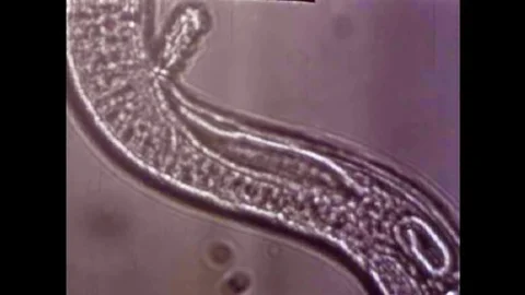 The parasite Trichonisis under a microscope begin reproducing in the 1940s Stock Footage 101200740