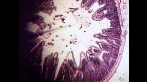 The parasite Trichonisis under a microscope begin reproducing in the 1940s Stock Footage 101200743