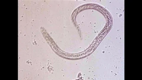 The parasite Trichonisis under a microscope begin reproducing in the 1940s Stock Footage 101200744