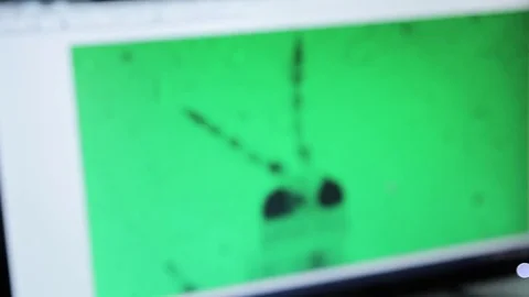 The parasite under a microscope, a video close-up Stock Footage 74927025