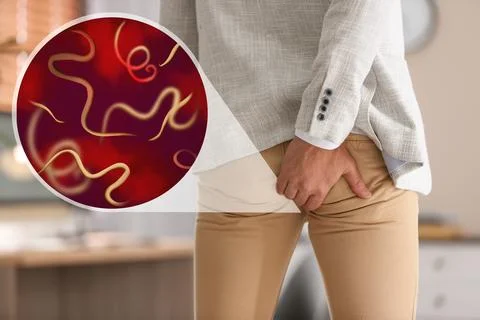 Parasites under microscope and man suffering from helminthiasis, closeup Photos