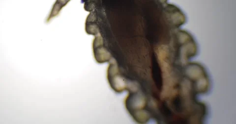 Parasitic head louse under microscope on white background Vidéo 333778447
