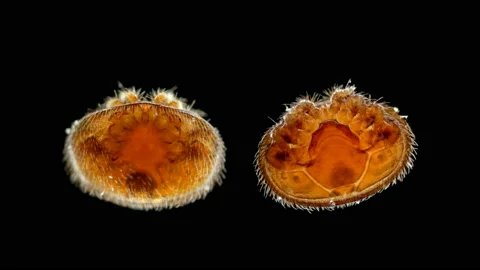 Parasitic mite Varroa under the microscope. Lives on Apis honey bees, causing Stock Footage 141516065