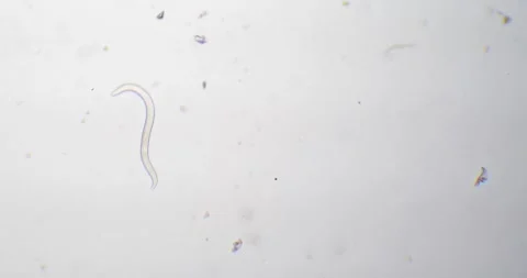 Parasitic nematode worm moving under a microscope Stock Footage 334950102