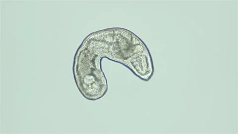 Parasitic Trematoda worm under microscope, possibly Brachyphallus crenatus Vidéo 250342244