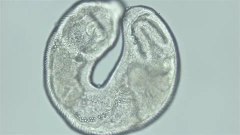 Parasitic Trematoda worm under microscope, Brachyphallus crenatus Stock Footage 250507743