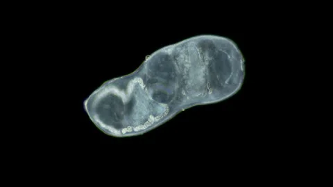 Parasitic Trematoda worm under microscope, Brachyphallus crenatus Vidéo 250508150
