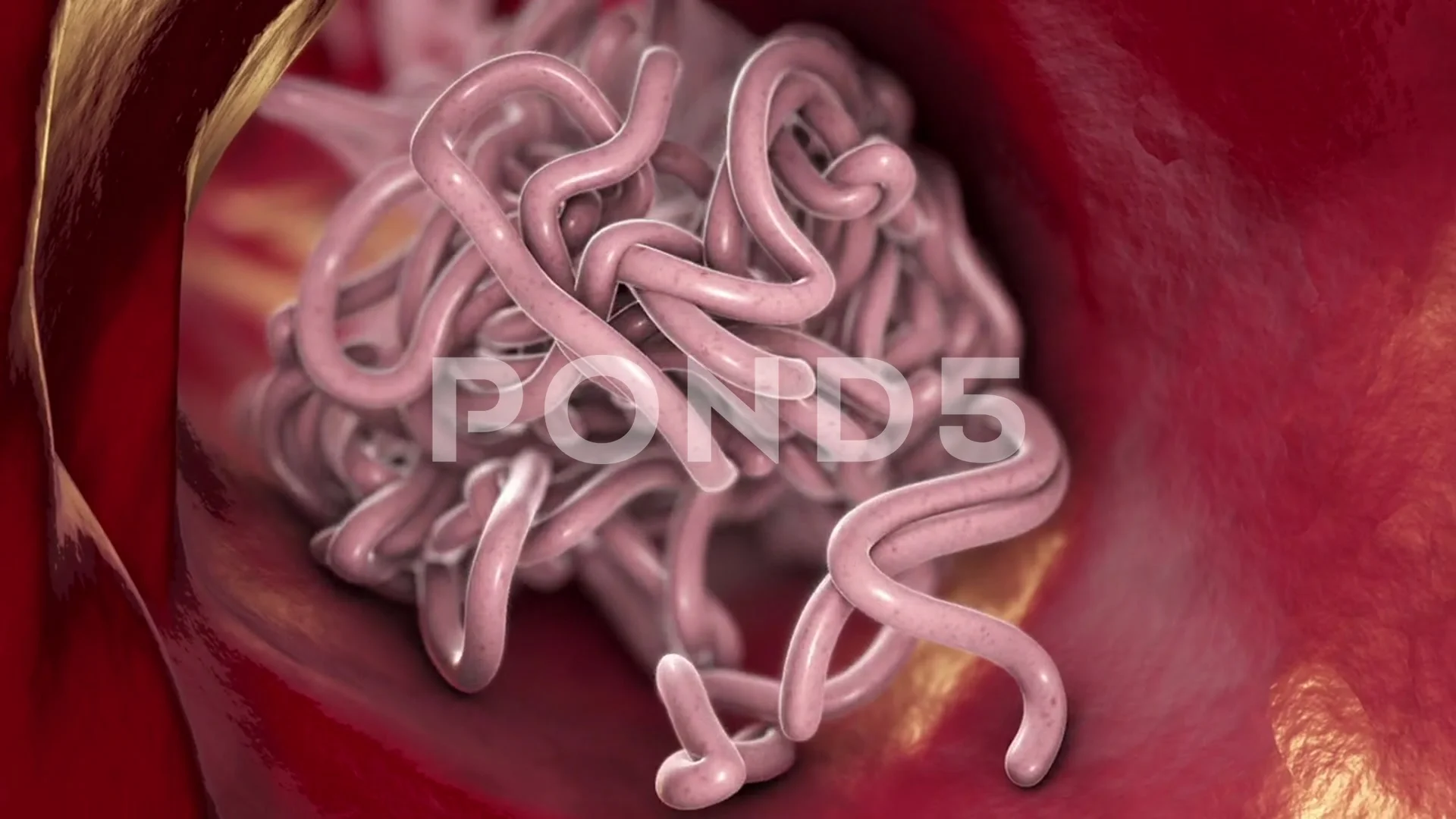 Parasitic worms in intestine, animation, Stock Video
