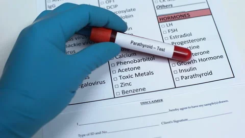 Parathyroid, doctor checking hormone in lab blank, showing blood sample in tube Stock Footage 103439195