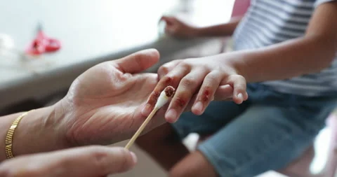 Parent helping her child perform first aid finger injury. Stock Footage 288843578