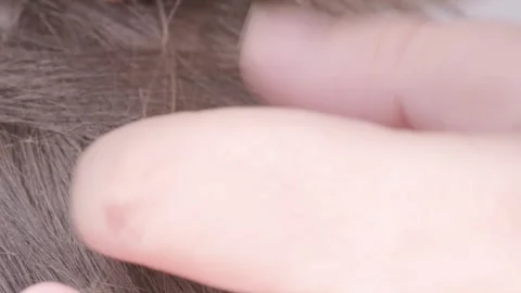 Parent's hands checking school-age child's hair for insects, searching for .. 스톡 동영상 276715022