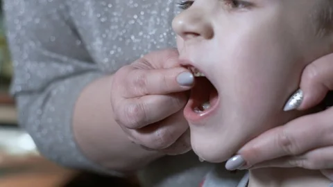 Parents trying to pull out son's wobbly decayed tooth. mom pulling tooth. Caries Stock Footage 119282968