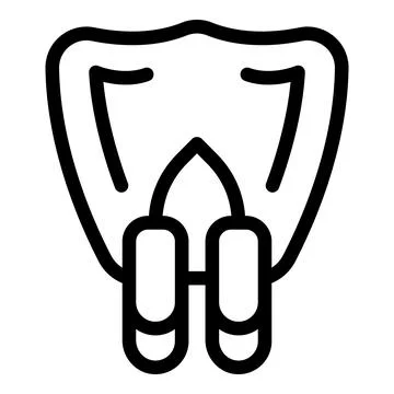 Parodontitis with dental implants showing gingivitis and periodontitis Illustrazione stock