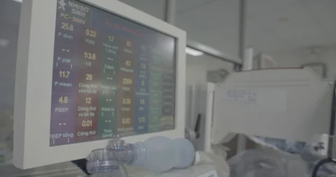 Part of incubator Intensive care unit , the screen Stock Footage 127744818