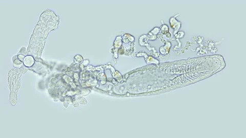 Part of Siphonophora colony under a microscope, class Hydrozoa. Trapping Stock Footage 169465662