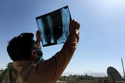 Partial annular solar eclipse seen from Pakistan, Quetta - 21 Jun 2020 Stock Photos