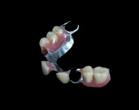 Partial denture on black background Stock Photos