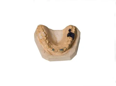A partial denture mounted on a plaster study model Stock Photos