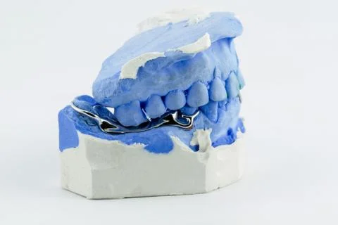 A partial denture Stock Photos