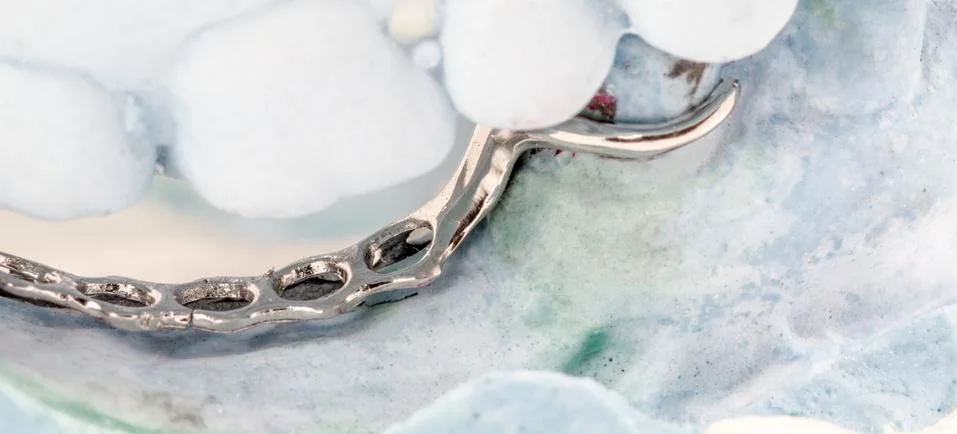 Partial denture on a plaster mold Stock-Fotos