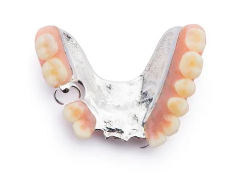 Partial denture upper side. Isolated on white background. Stock Photos