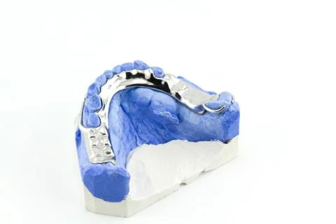 Partial denture on white background Stock Photos