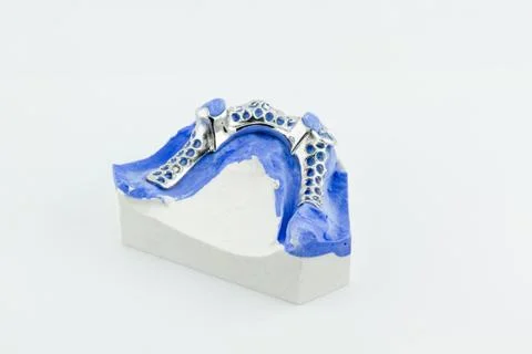 Partial denture on white background 库存照片