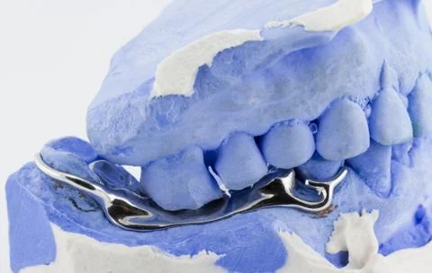 A partial denture on white background Stock Photos