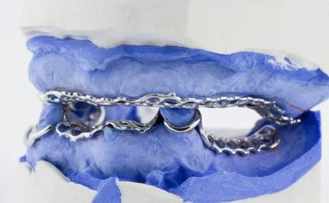A partial denture on white background Stock Photos