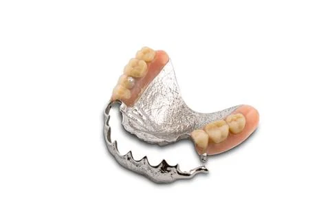Partial metal removable swinglock denture isolated on white background. Foto stock