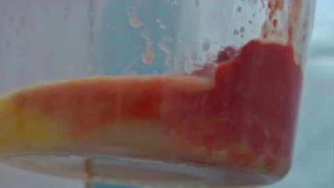 Partial removal of fat and mucous tissues. Fat liquid in the bottle from Video stock 83202642