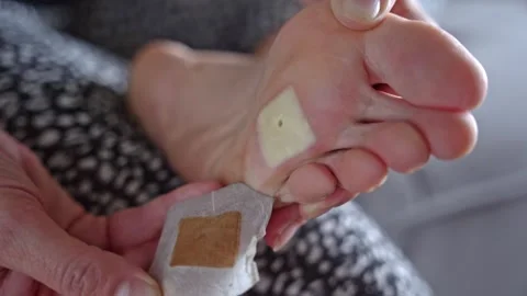 A patch for the treatment of calluses on the foot. callous with a root close-up. Stock Footage 250122856