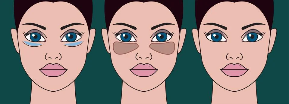 Patch under eyes Stock Illustration