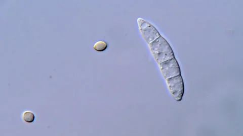 Pathogenic Fusarium Spores Viewed Under DIC Microscope, 1000x Stock-Footage 317810085