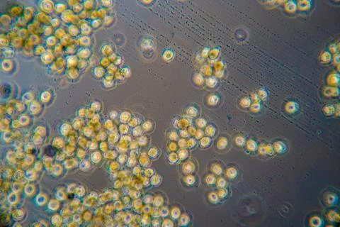 Pathogens magnified by a microscope Stock Photos