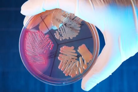 Pathological bacteria Stock Photos