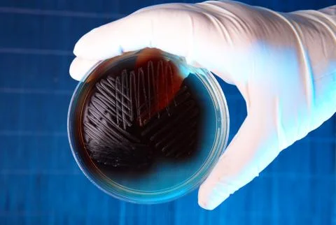 Pathological bacteria Stock Photos