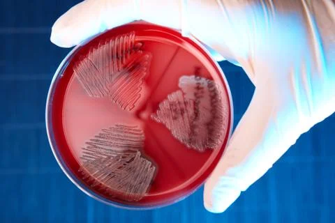 Pathological bacteria Stock Photos