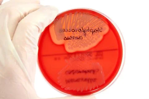 Pathological bacteria Stock Photos
