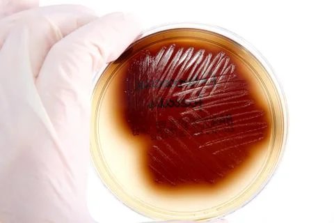 Pathological bacteria Stock Photos