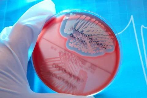 Pathological bacteria Stock Photos