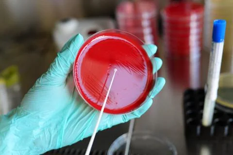 Pathological bacteria test Stock Photos