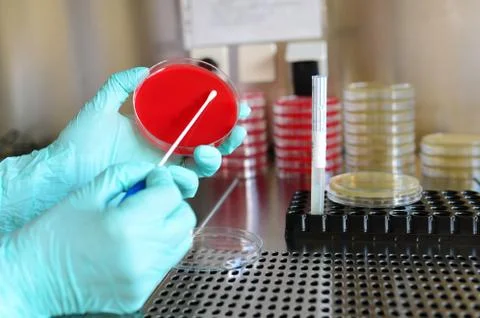 Pathological bacteria test Stock Photos