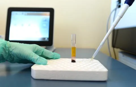 Pathological bacteria test Stock Photos
