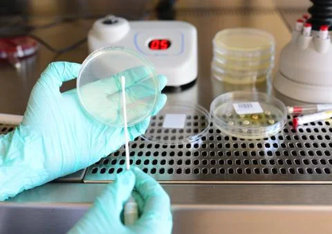 Pathological bacteria test Stock Photos
