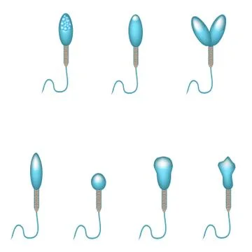 Pathological forms of sperm in the ejaculate. Male infertility Oligospermia Stock Illustration