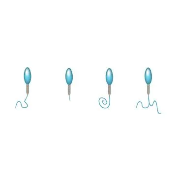 Pathological forms of sperm in the ejaculate. Male infertility Oligospermia Stock Illustration