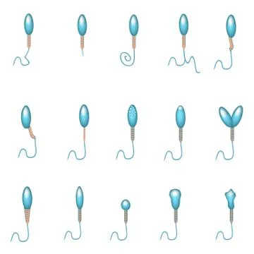 Pathological forms of sperm in the ejaculate. Male infertility Oligospermia Stock Illustration