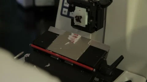 Pathologist cutting and taking tissue sample for analyzing in the lab, close up. Stock Footage 53084179