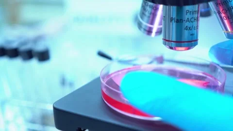 A pathologist is studying diseased tissue under a microscope. 2k 60fps Stock Footage 336583334